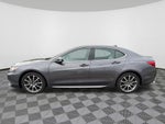 2018 Acura TLX 3.5L V6 w/Technology Package