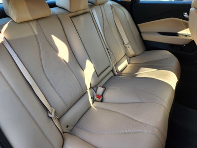 2025 Acura TLX Technology Package