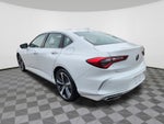 2025 Acura TLX Technology Package