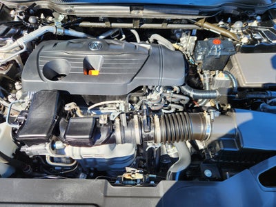 2025 Acura TLX Technology Package